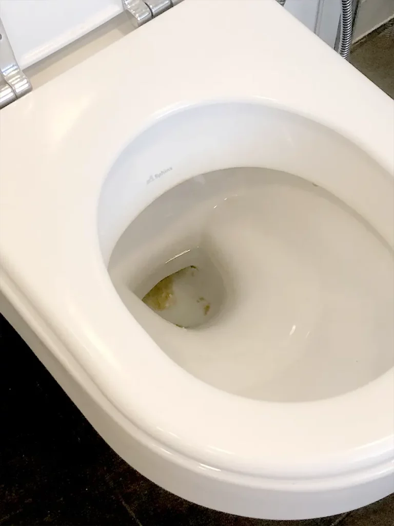 how to get rid of brown stains in toilet